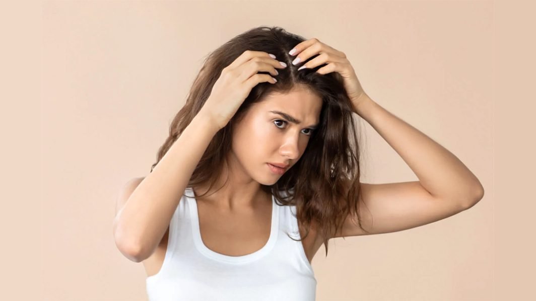 Seborrheic Dermatitis: An Over-the-Counter Remedy