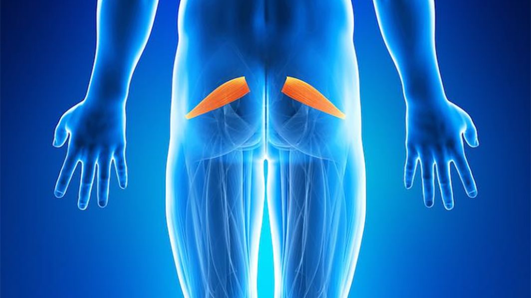 What you need to know about Piriformis Syndrome
