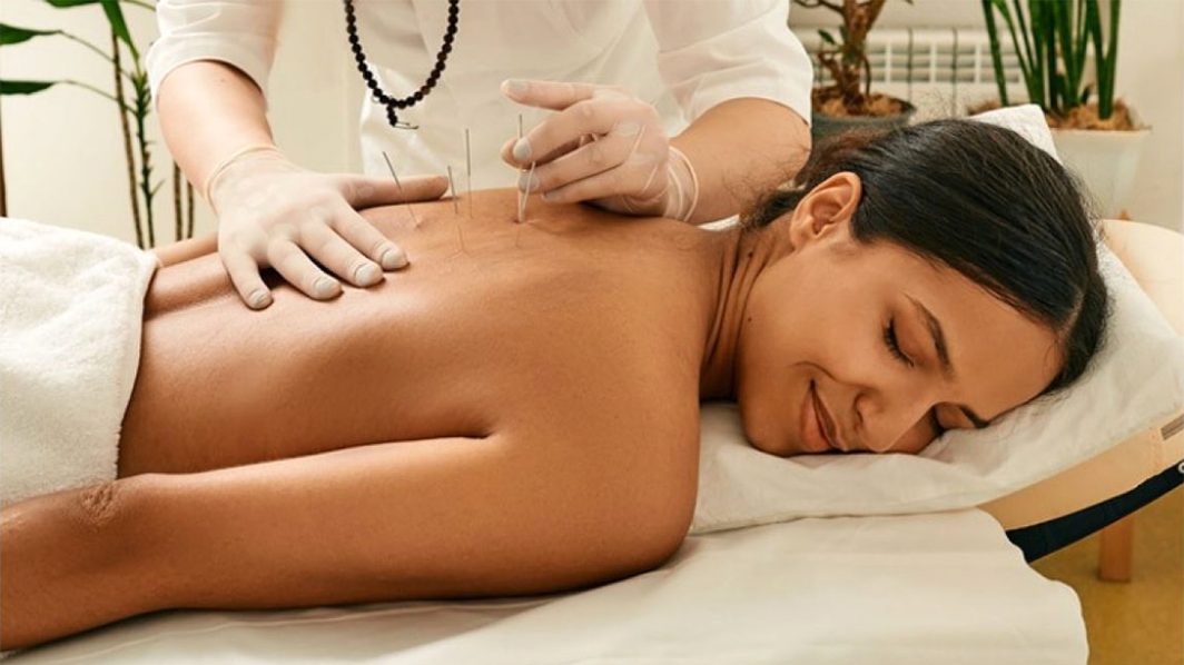 Acupuncture, Massage, and Chiropractic for Fibromyalgia