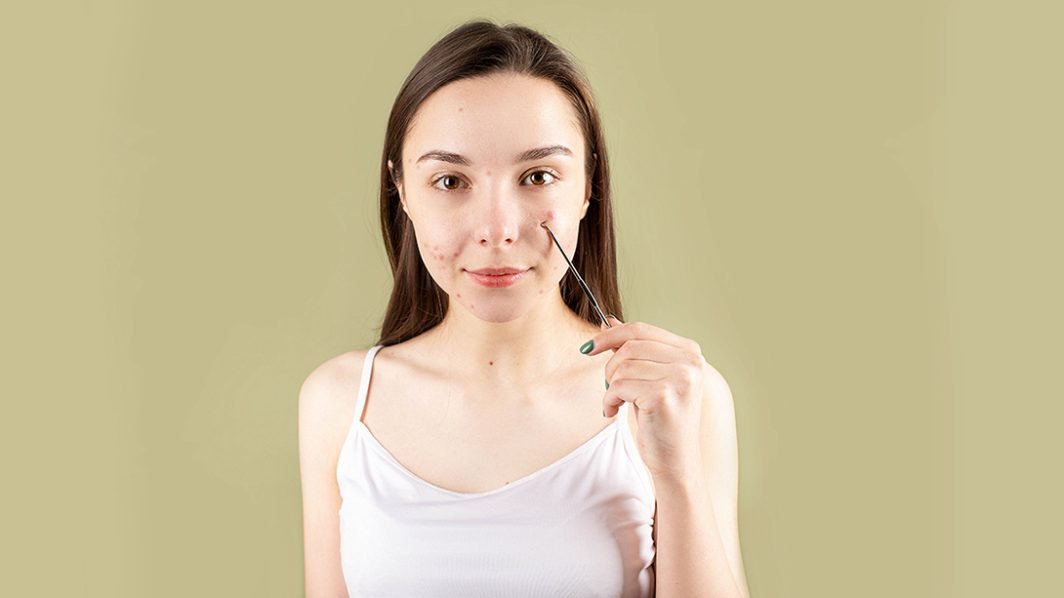An acne fetish is no laughing matter