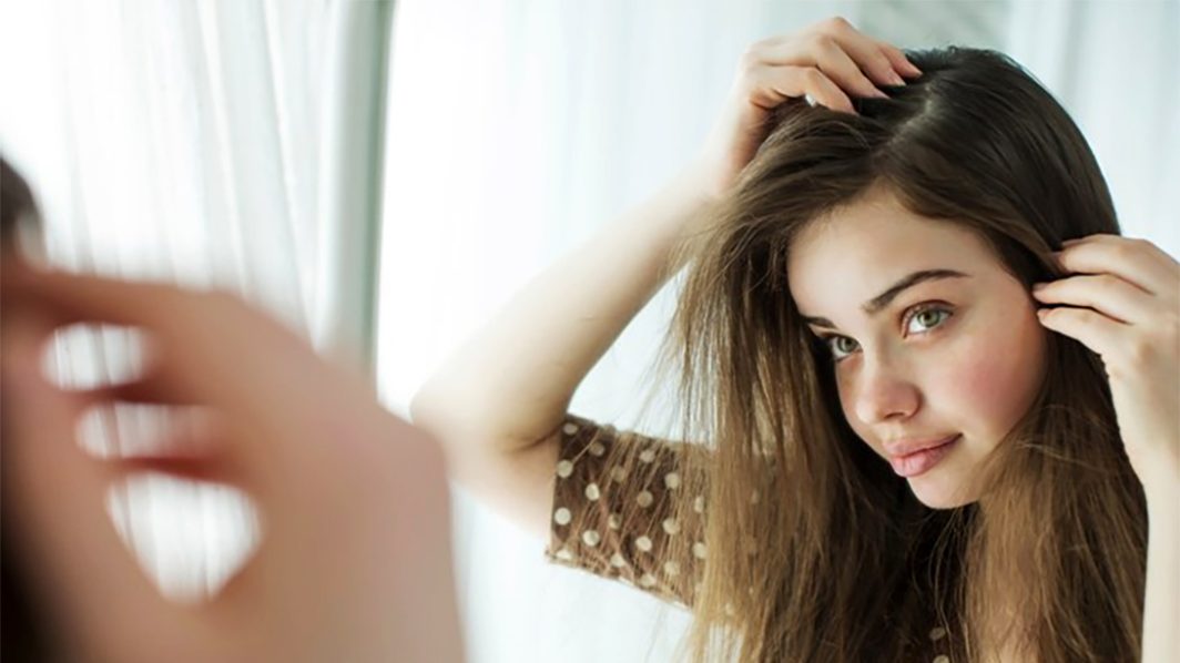 Coping with alopecia areata
