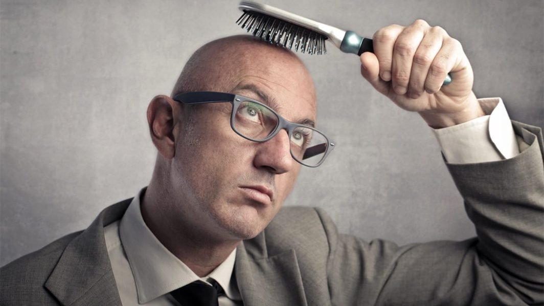 Coping with male pattern baldness