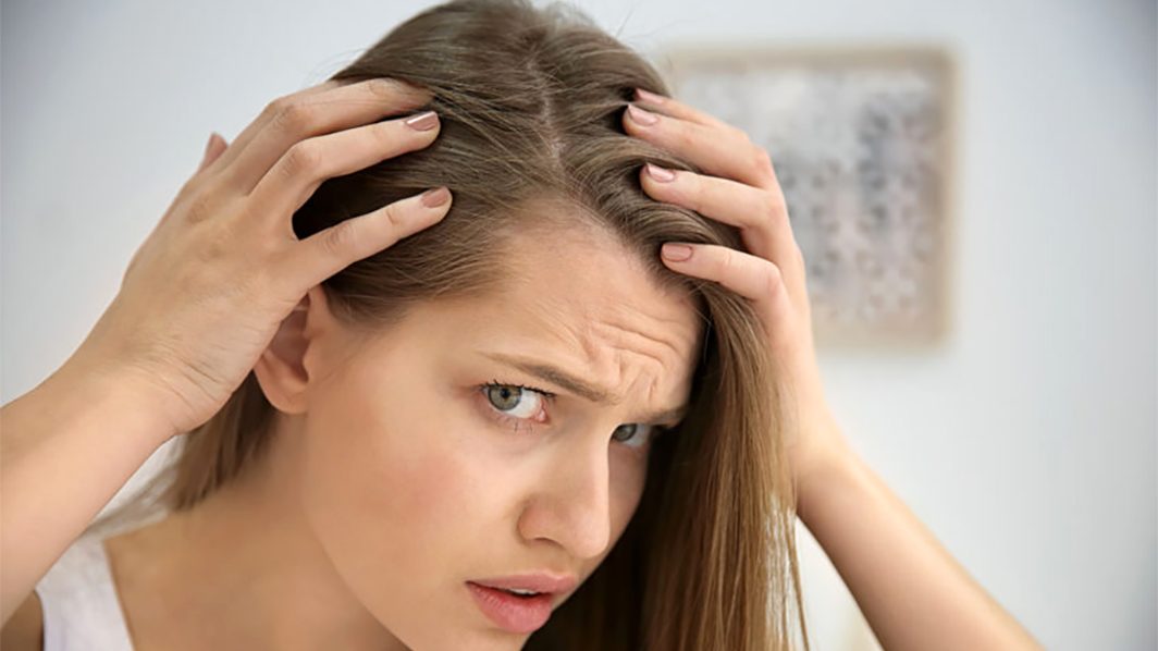 Coping with telogen effluvium