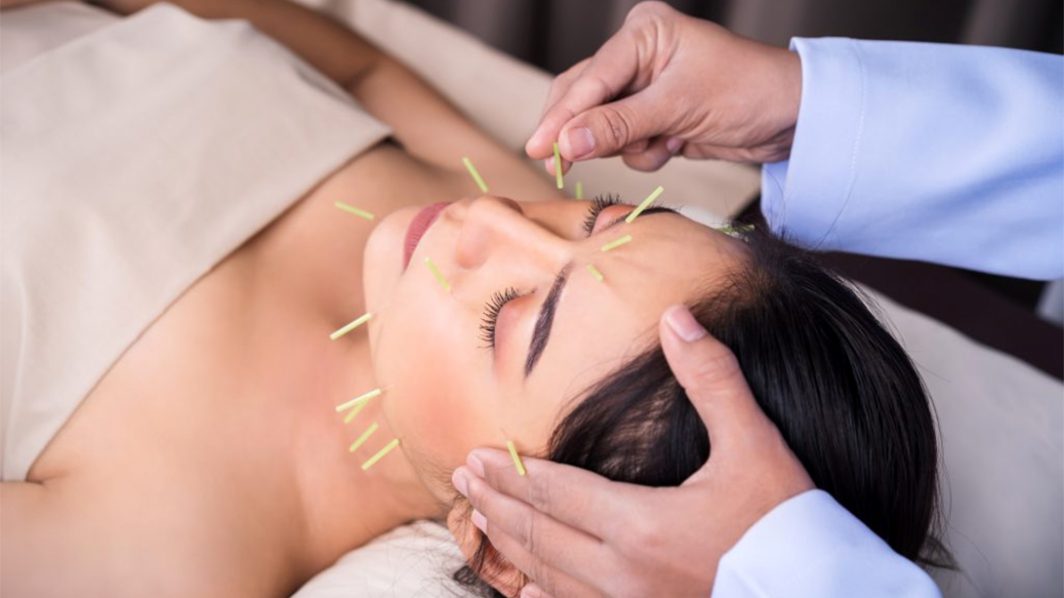 How to Treat Your Migraines Yourself with Acupressure