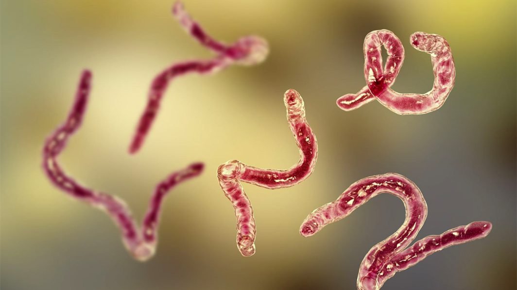 Parasites: The Missing Diagnosis?