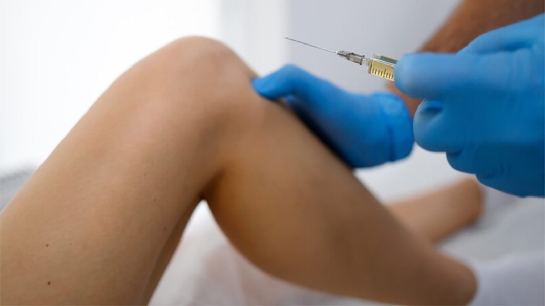 Synvisc Treatment Can Be Legally Imported from Canada