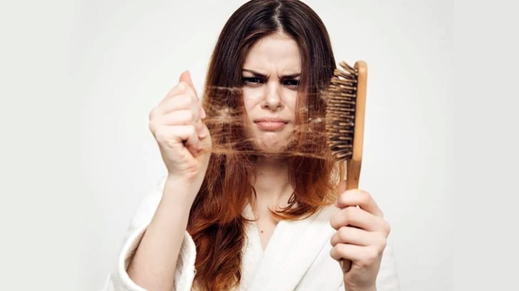 What are the common hair loss causes?