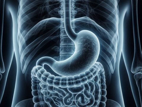 The Cause of Stomach Ulcers Bacteria Or Bad Lifestyle