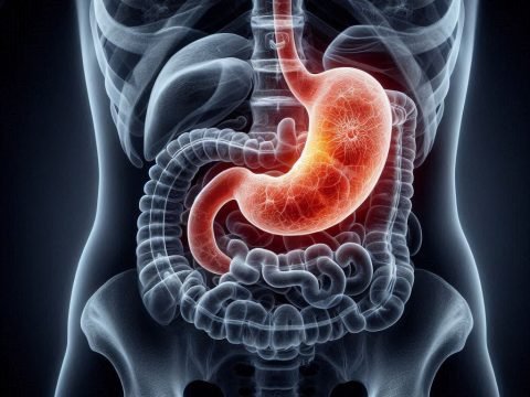 The Post Gastric Bypass Choice Could Be Your Vitamins Or A Wheelchair