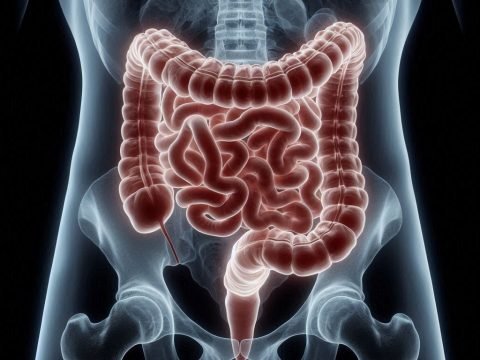 5 Real Methods Of Colon Cancer Prevention