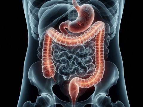 Colon Cancer Facts