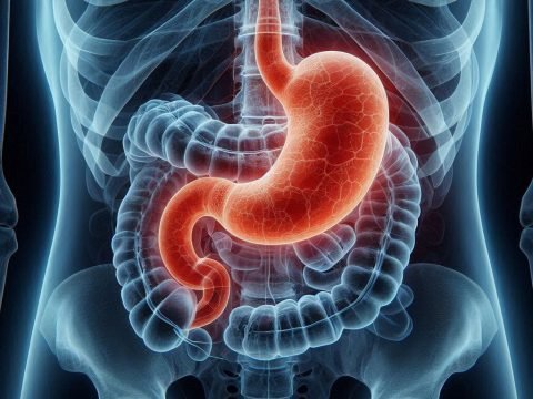 How Much Does Lap Band Weight Loss Surgery Cost