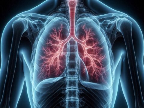 Mesothelioma's Convoluted Settlement Issues